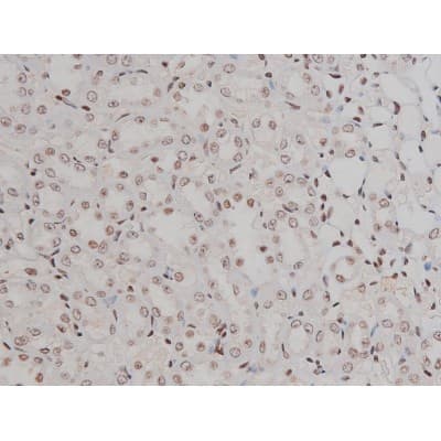 IGF1R / IGF1 Receptor Antibody (phospho-Tyr1346)