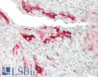 IHC-plus™ CLU / Clusterin Antibody (aa44-58)