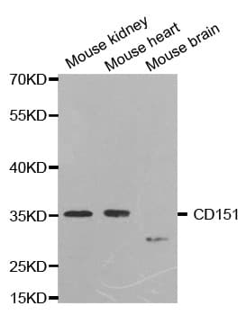Polyclonal Rabbit anti-Human CD151 Antibody (IHC, WB)