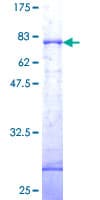 Human DAPK1 / DAP Kinase Protein (Recombinant GST)
