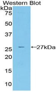 CYR61 Antibody (aa178-381)