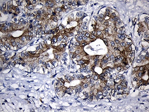 CPT1B Antibody (aa187-440, clone OTI2A6)