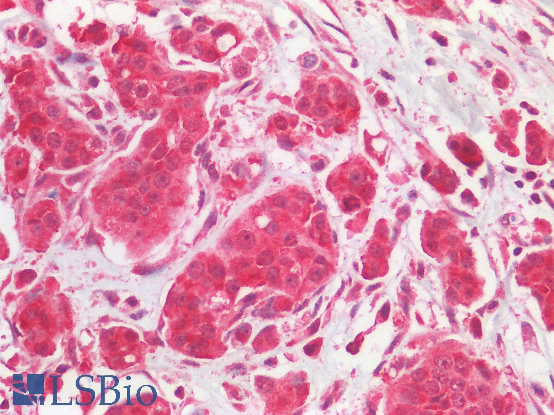 IHC-plus™ EGFR Antibody (C-Terminus)
