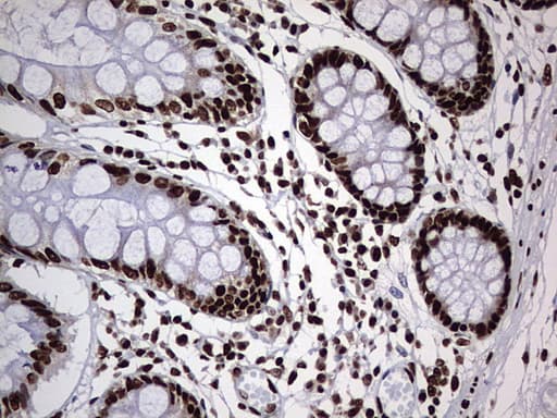 HNRPM / HNRNPM Antibody (aa1-261, clone OTI6H7)