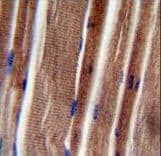 THUMPD3 Antibody (aa194-223)