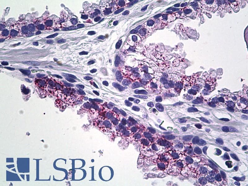 IHC-plus™ MMP23 Antibody (C-Terminus)