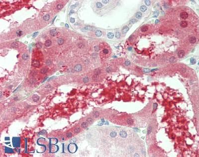 AGRN / Agrin Antibody