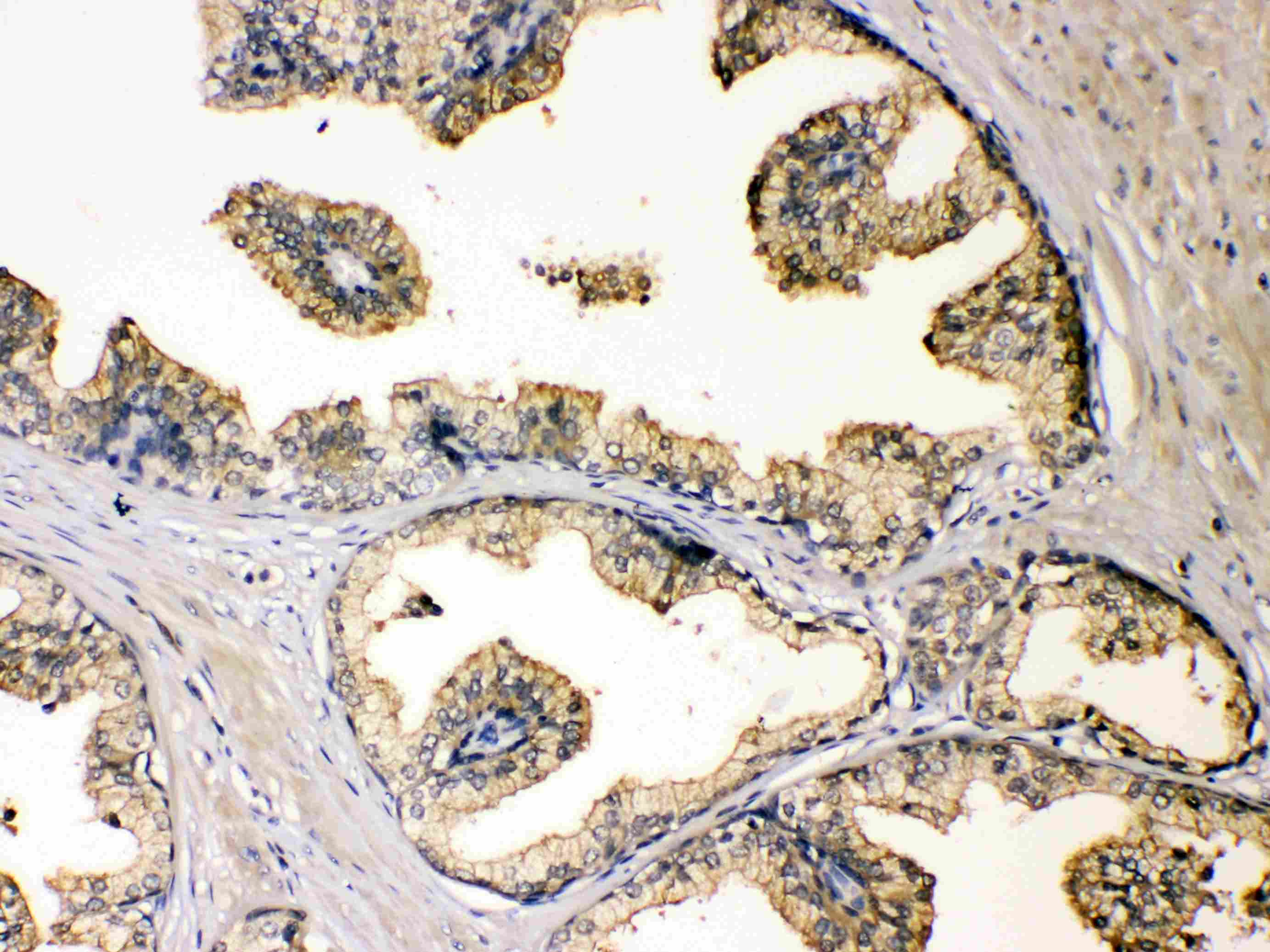DBI / ACBD1 Antibody