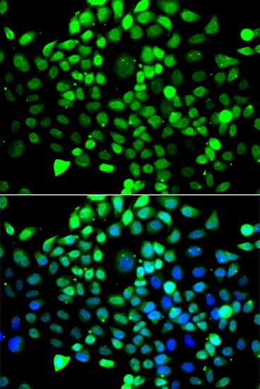 XRCC6 / Ku70 Antibody