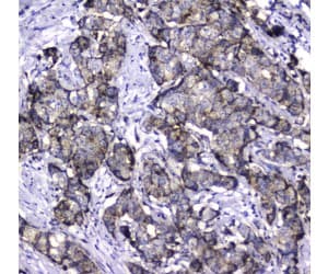 Polyclonal Rabbit anti-Human MAC-2-BP / LGALS3BP Antibody (IHC, WB)