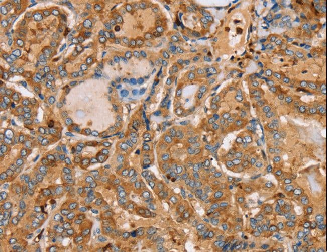 PLS3 / T Plastin Antibody