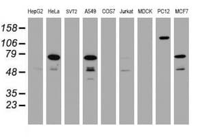 RIPK1 / RIP Antibody (clone OTI2F1)
