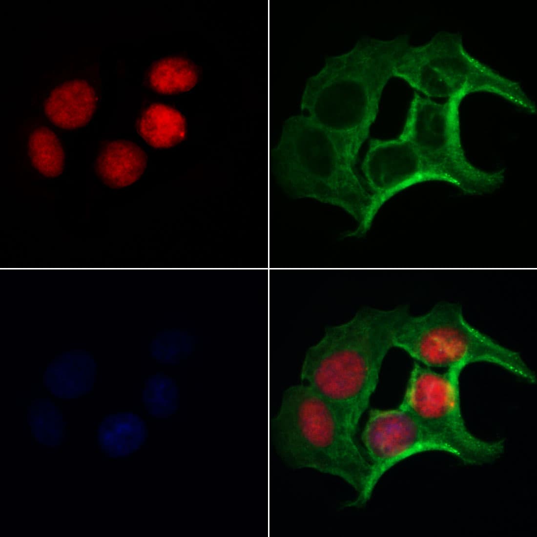 FLCN / Folliculin Antibody