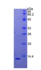 Human BAFF Receptor / CD268 Protein (Recombinant His)
