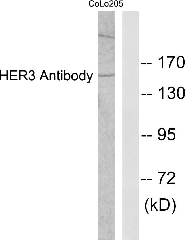 Polyclonal Rabbit anti-Human ERBB3 / HER3 Antibody (aa1-50, IHC, WB)