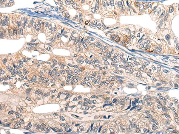 EPHA6 / EPH Receptor A6 Antibody
