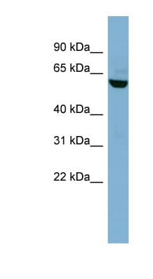 PVRL3 / Nectin-3 Antibody (aa143-192)