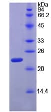 Rat RPP40 / Ribonuclease P Protein (Recombinant His, N-Terminal)