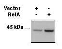 HLA-A/B/C Antibody (clone W6/32)