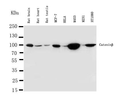 Polyclonal Rabbit anti-Human CTNNB1 / Beta Catenin Antibody (aa1-19, IHC, WB)