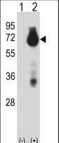 Polyclonal Rabbit anti-Human BIRC3 / cIAP2 Antibody (aa59-88, IHC, IF, WB)
