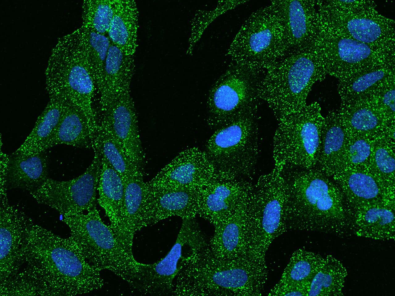 Polyclonal Rabbit anti-Human ARHGAP17 / NADRIN Antibody (IF)