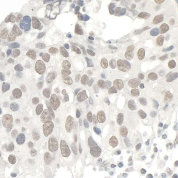 Polyclonal Rabbit anti-Human TRIM28 / KAP1 Antibody (aa650-700, IHC, WB)