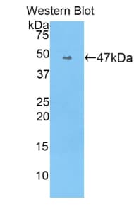ACE / CD143 Antibody (aa918-1088)