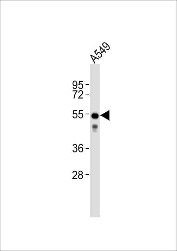 KRT7 / CK7 / Cytokeratin 7 Antibody