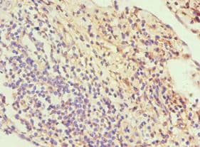 Polyclonal Rabbit anti-Human SLC2A1 / GLUT-1 Antibody (aa210-310, IHC, WB)
