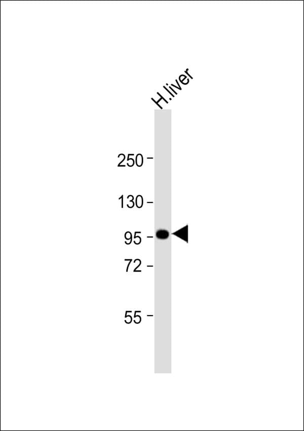 DMGDH Antibody