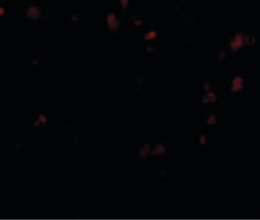 Polyclonal Rabbit anti-Human TMC6 Antibody (IHC, IF, WB)