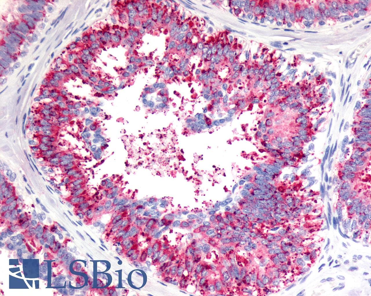 IHC-plus™ Polyclonal Rabbit anti-Human V1RL1 / VN1R1 Antibody (C-Terminus, IHC)