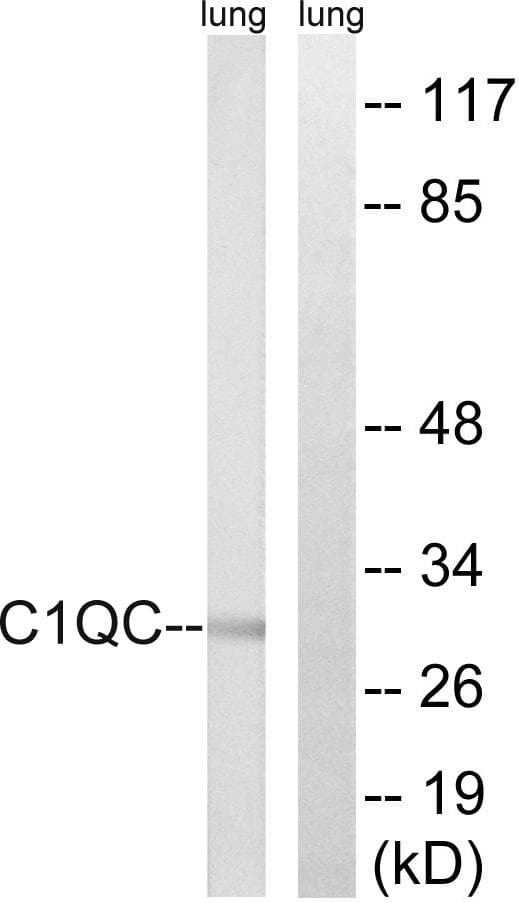 C1QG / Complement C1QC Antibody