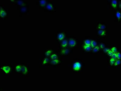 IHC-plus™ Polyclonal Rabbit anti-Human CD3E Antibody (aa 23-207, IHC, WB)