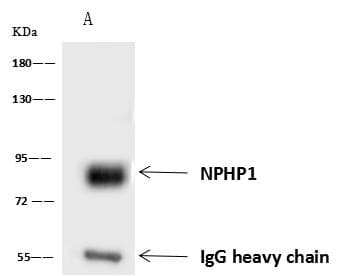 NPHP1 / Nephronophthisis Antibody