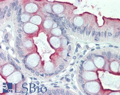 IHC-plus™ PLA2G2D Antibody