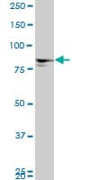Monoclonal Mouse anti-Human MTA1 Antibody (clone 4D5, WB)