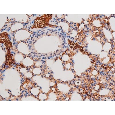 ADD1 / Adducin Alpha Antibody (phospho-Ser726)
