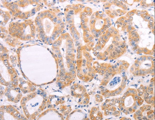 VHL / Von Hippel Lindau Antibody