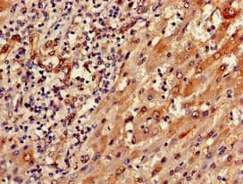 SEMA6A / Semaphorin 6A Antibody