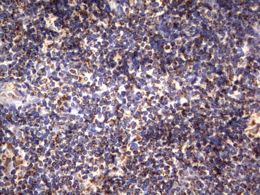 Monoclonal Mouse anti-Human HADH Antibody (clone UMAB151, aa57-314, IHC, WB)