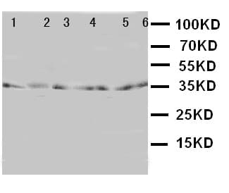Polyclonal Rabbit anti-Human TRAM1 Antibody (aa314-331, IHC, WB)