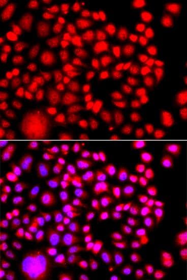 TESK2 Antibody