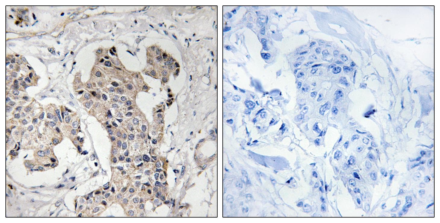 BLK Antibody (Ab-501)