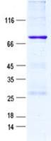 Human DES / Desmin Protein (Recombinant GST, N-terminus + His, C-terminus)