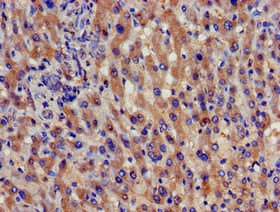 SPG21 / MAST Antibody