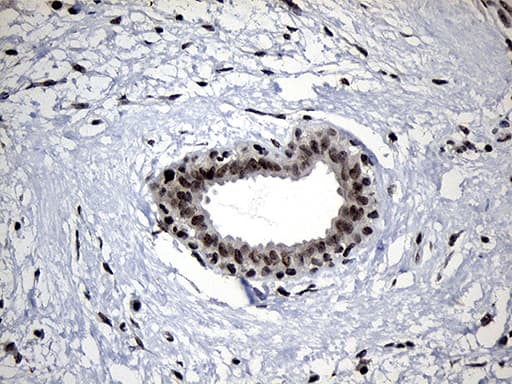 ELL / MEN Antibody (aa302-621, clone OTI2H7)
