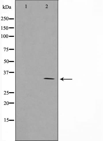 SURF1 Antibody
