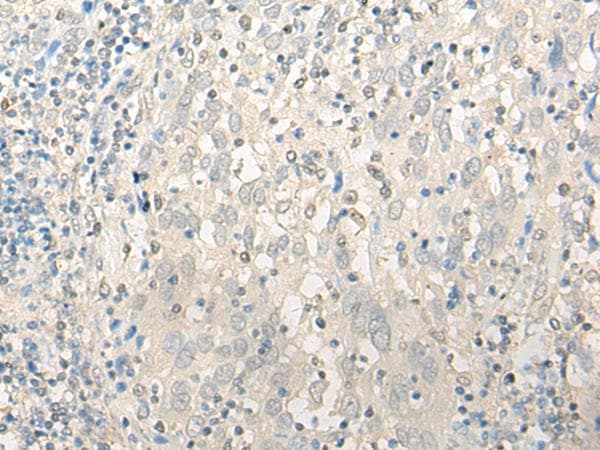 UBXN1 Antibody